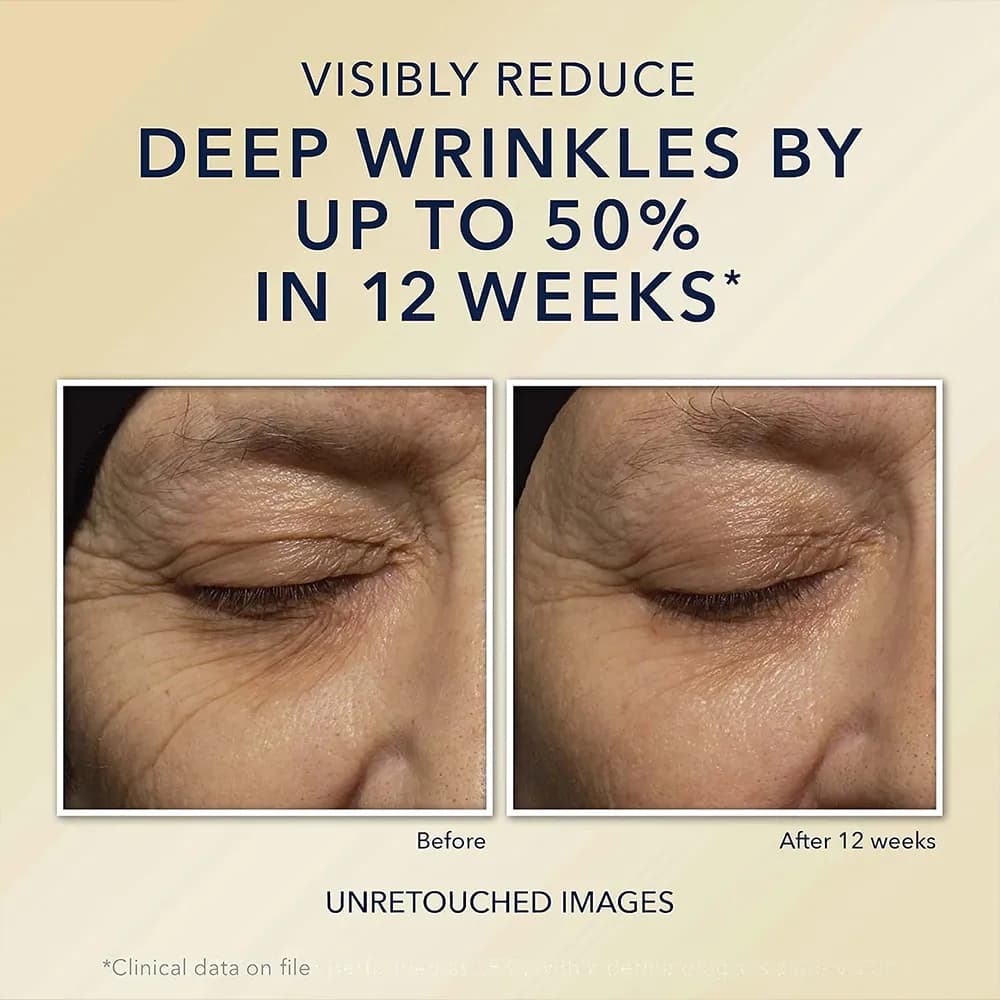 مرطوب کننده روزانه ضد چروک عمیق رتینول راک Roc کورکسیون با SPF 30 حجم 15 و 38 میل اصل آمریکا — تصویر ۵