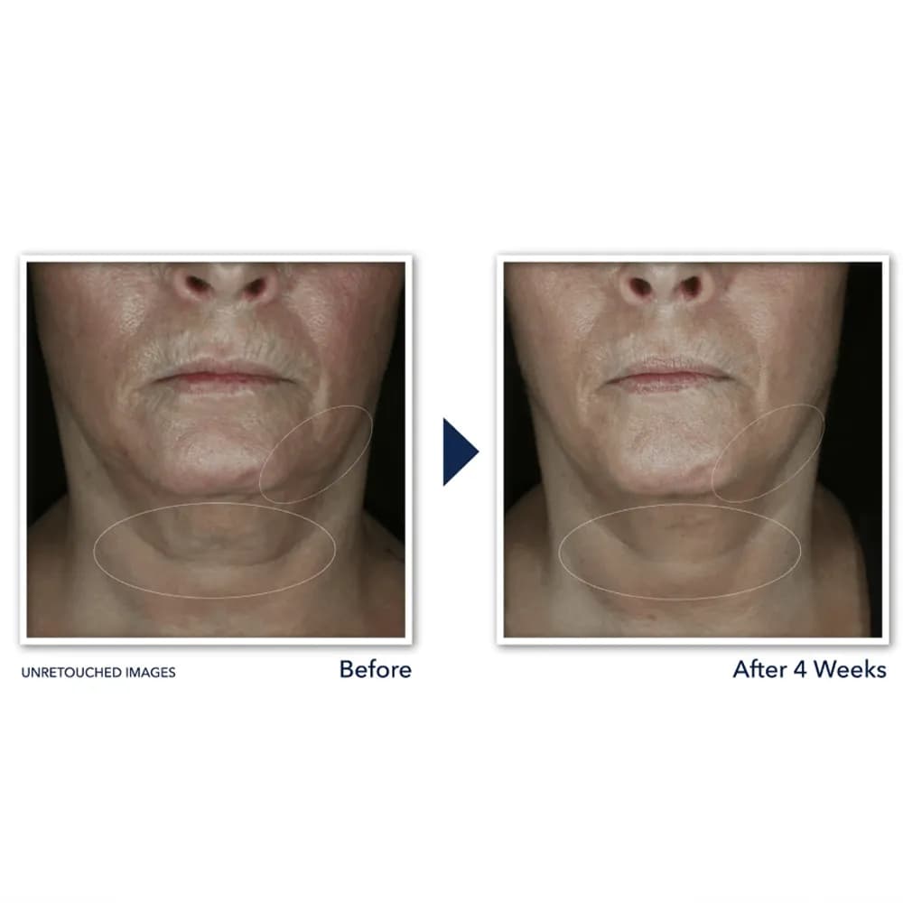 کرم رتینول لیفت کننده آبرسان راک Roc صورت و گردن مدل derm correxion contour cream اصل آمریکا — تصویر ۴