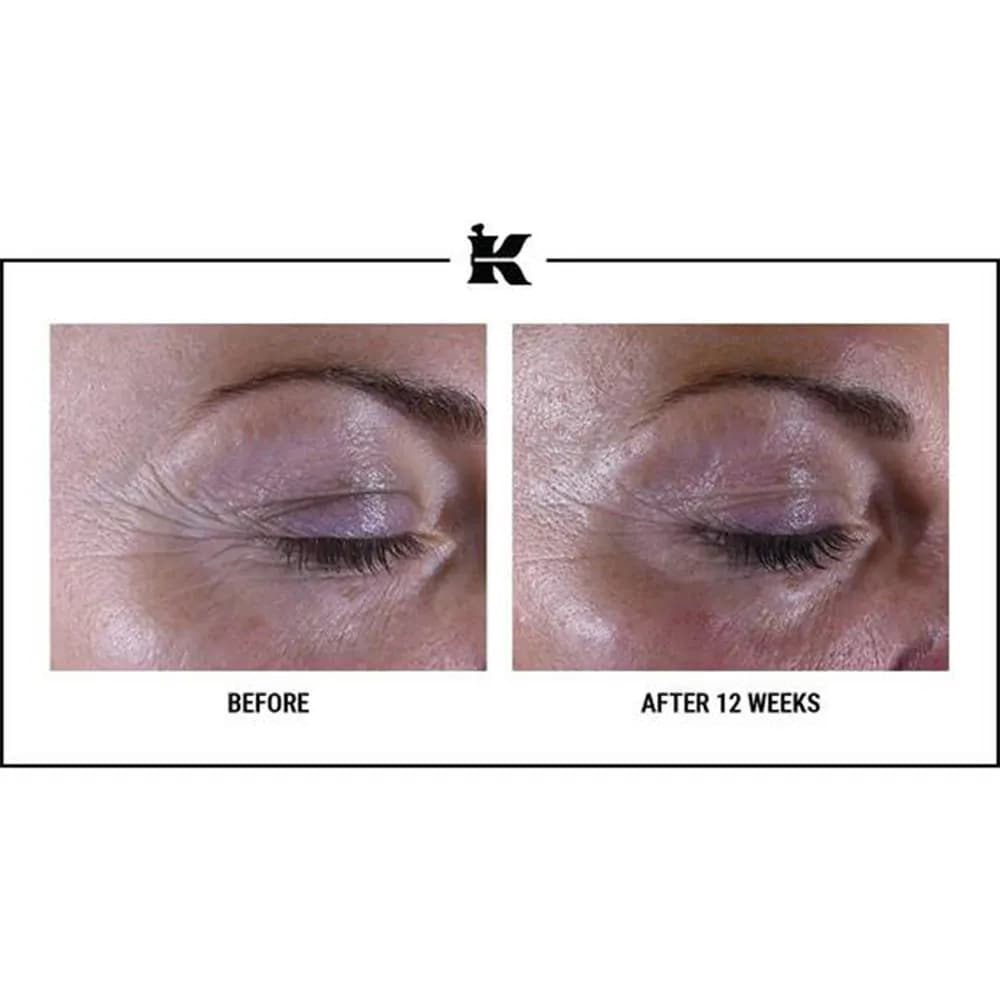 کرم دور چشم ضد پیری کیلز kiehls مدل سوپر مولتی کارکتیو ساخت آمریکا خرید فرانسه اورجینال — تصویر ۱۲