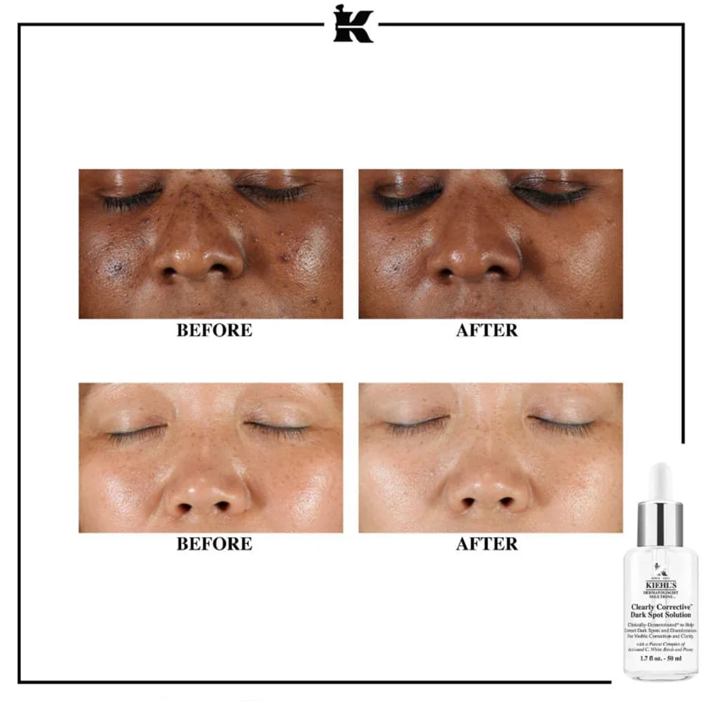 سرم ضد لک، روشن کننده و شفاف کننده قوی کیلز Kiehl’s حجم 30 میل | حذف لک و روشن کننده و جوانساز — تصویر ۸