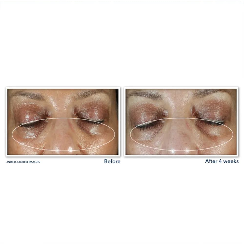 کرم دور چشم لیفتینگ و تیرگی راک Roc ضد تیرگی و لیفت قوی MULTI CORREXION® Even Tone + Lift Eye Cream اصل آمریکا — تصویر ۷