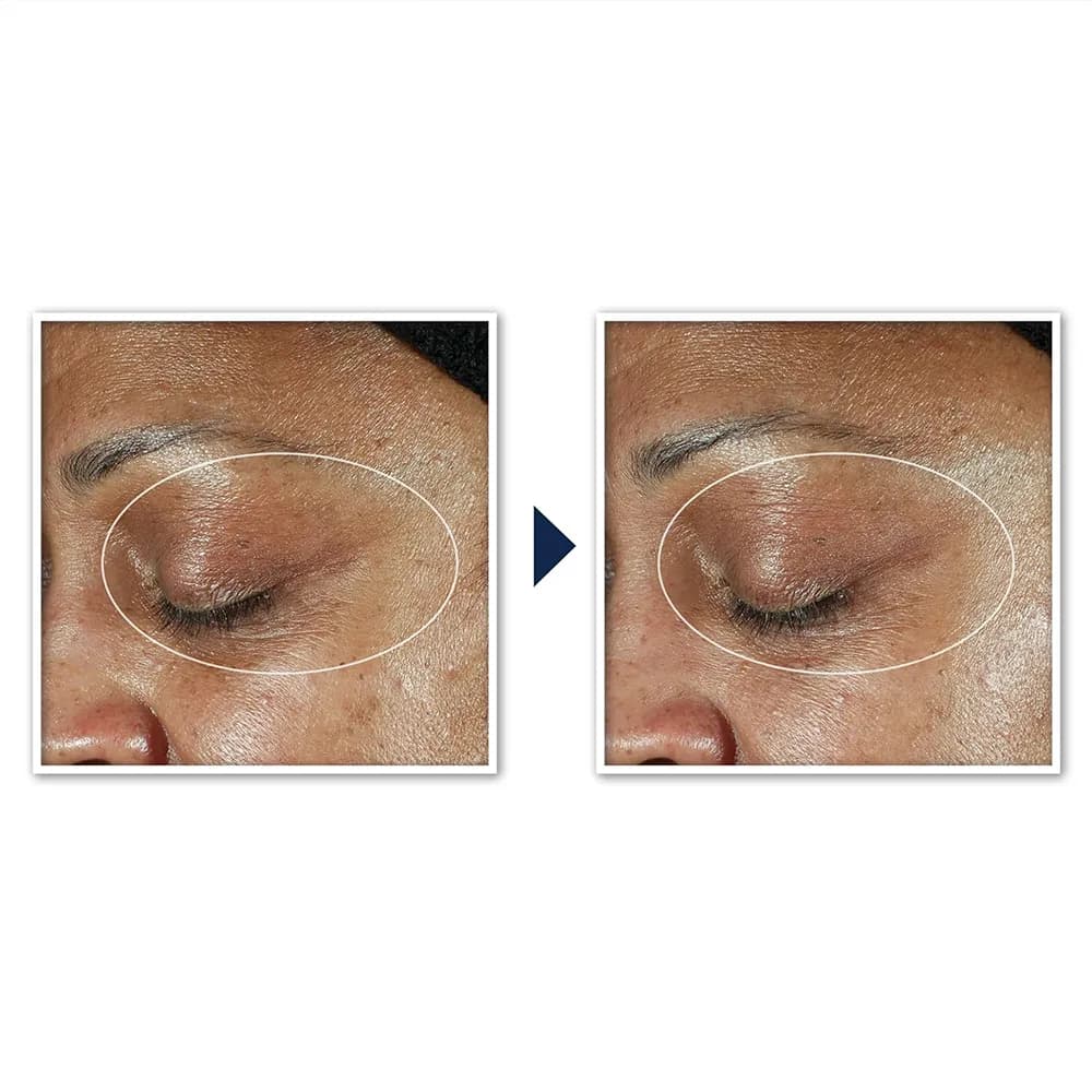 کرم دور چشم لیفتینگ و تیرگی راک Roc ضد تیرگی و لیفت قوی MULTI CORREXION® Even Tone + Lift Eye Cream اصل آمریکا — تصویر ۸