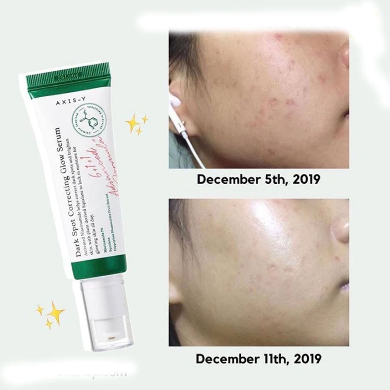 سرم ضد لک اکسیس وای Axis Y Dark Spot Correcting Serum — تصویر ۲