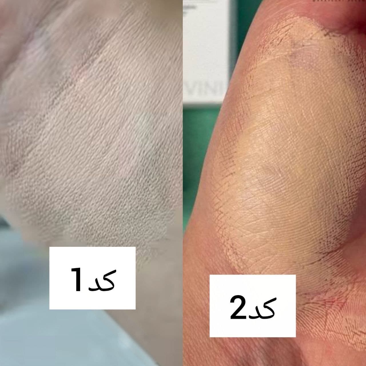 کانسیلر کره ای cappuvini کانسیلر پینترستی بدون پوسته شدن روی صورت — تصویر ۳