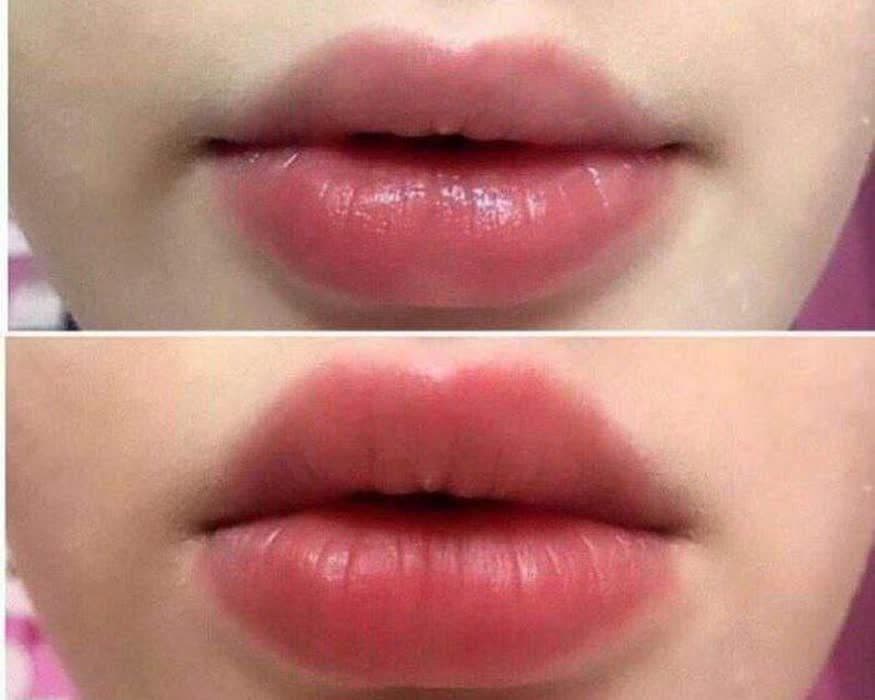 حجم دهنده لب مینیKiss Beauty — تصویر ۲