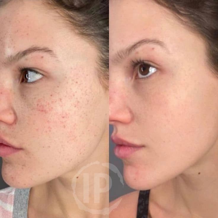 بلک ماسک استوینت Ostwint با خاصیت Peel Off حجم 150ml — تصویر ۵