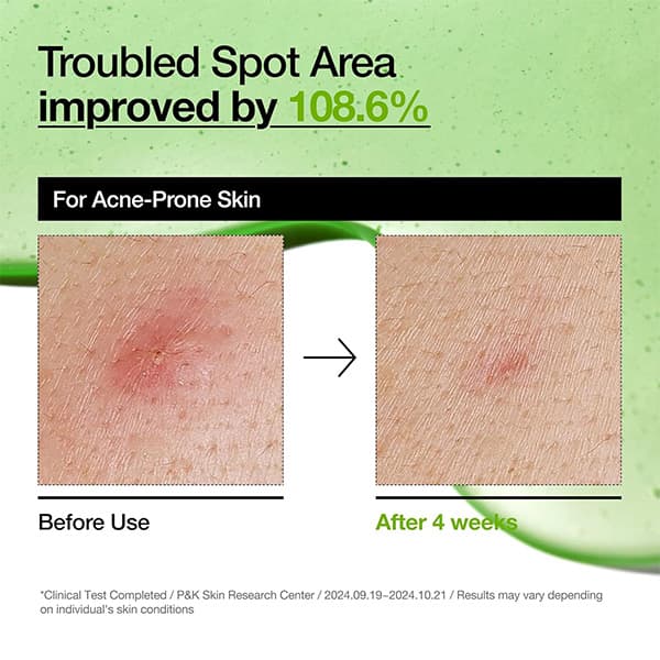 سرم آزلائیک اسید 10% و هیالورون آنوا حجم 30 میل — تصویر ۶