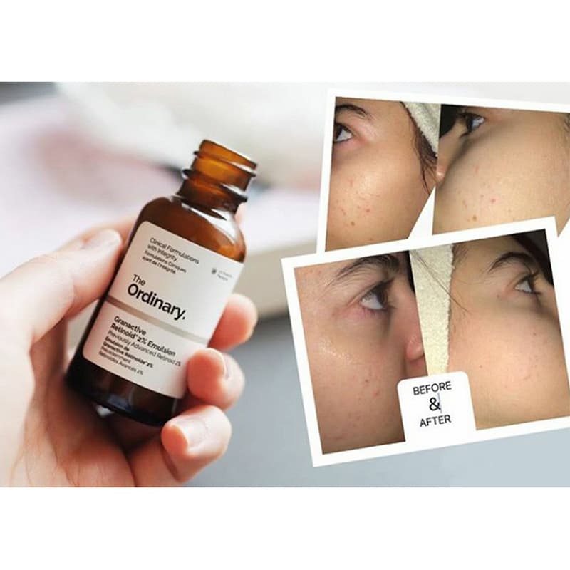 سرم گرن اکتیو رتینوئید 2٪اوردینری 30میل — تصویر ۲