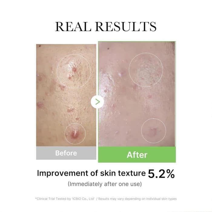 سرم اگزوزوم سیکا مدی‌کیوب | Medicube Cica Serum اصل — تصویر ۲