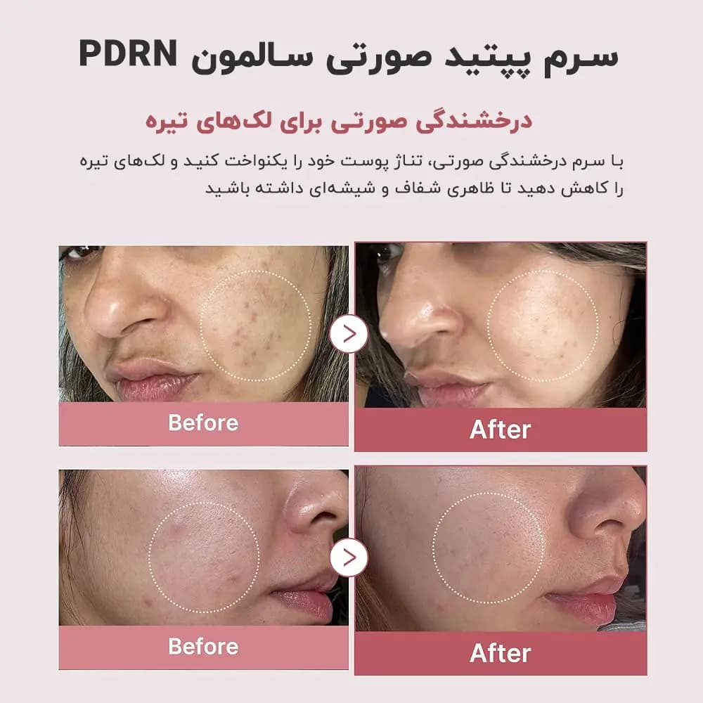 سرم پپتاید صورتی PDRN مدی‌کیوب | ترمیم و جوانساز پوست | Medicube — تصویر ۷