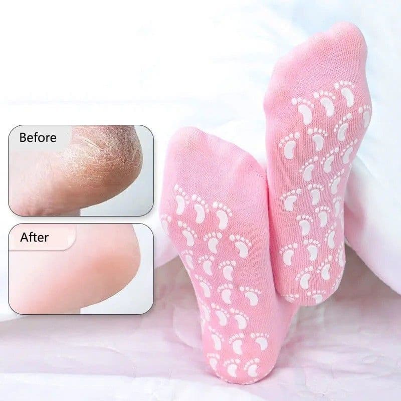 جوراب سیلیکونی مرطوب‌کننده MOISTURISING – درمان مؤثر ترک پا — تصویر ۵