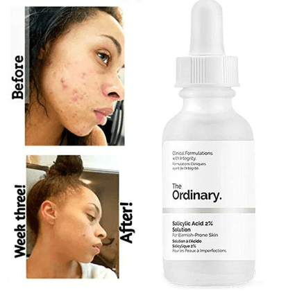 سرم ضد جوش سالیسیلیک اسید 2% سلوشن اوردینری(اصل) The Ordinary Salicylic Acid 2% Solution — تصویر ۵