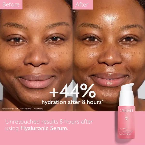 سرم آبرسان هیالورونیک اسید کدالی VinoHydra Hyaluronic Acid Serum — تصویر ۴