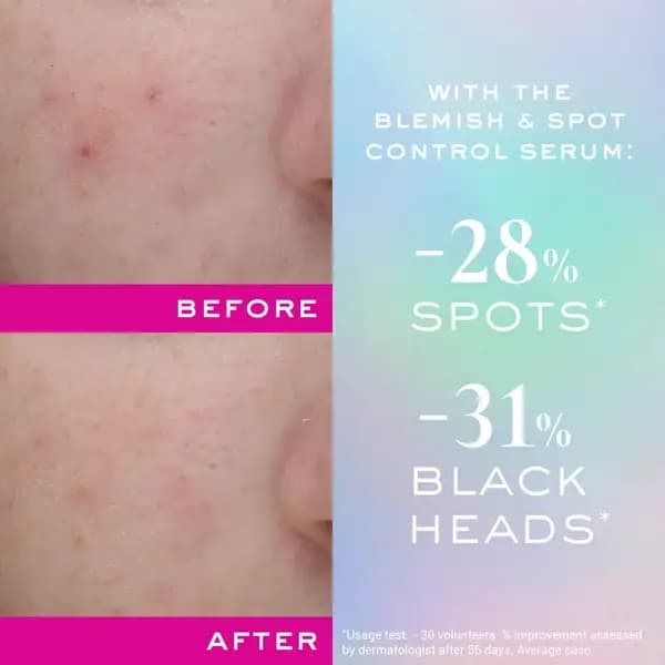 سرم ضد جوش و ضد لک زینک پاور نوکس NUXE Zinc Power Anti-Imperfections Anti-Boutons Serum — تصویر ۵