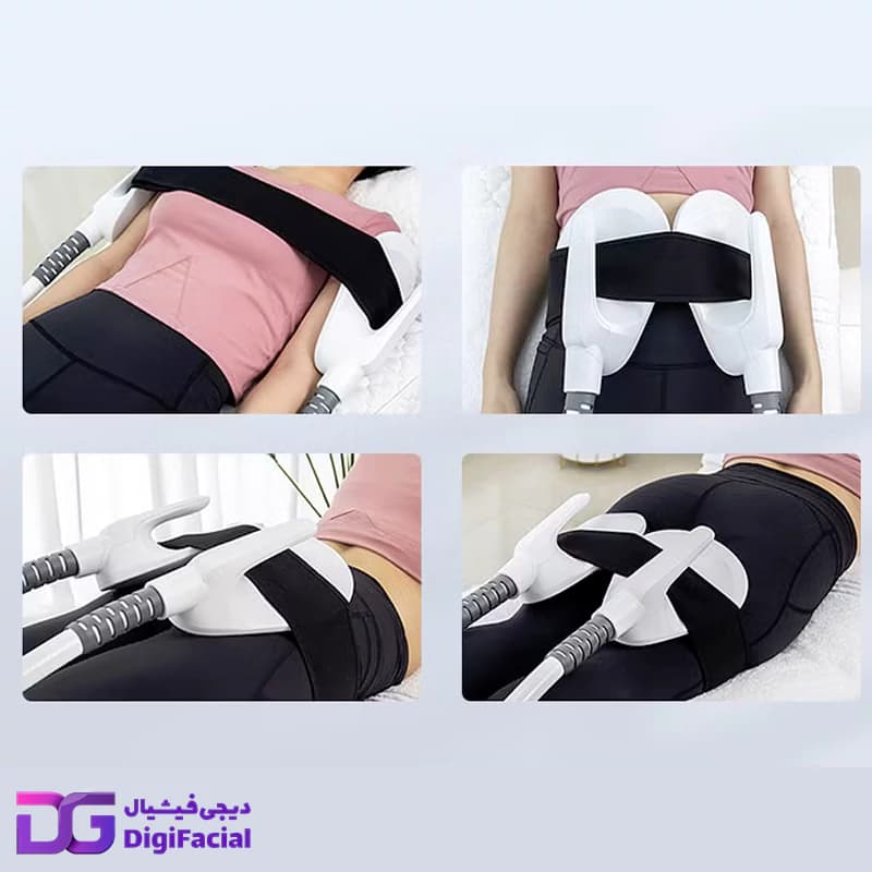 دستگاه لاغری و عضله ساز ام اسکالپت EMSCULPT — تصویر ۸
