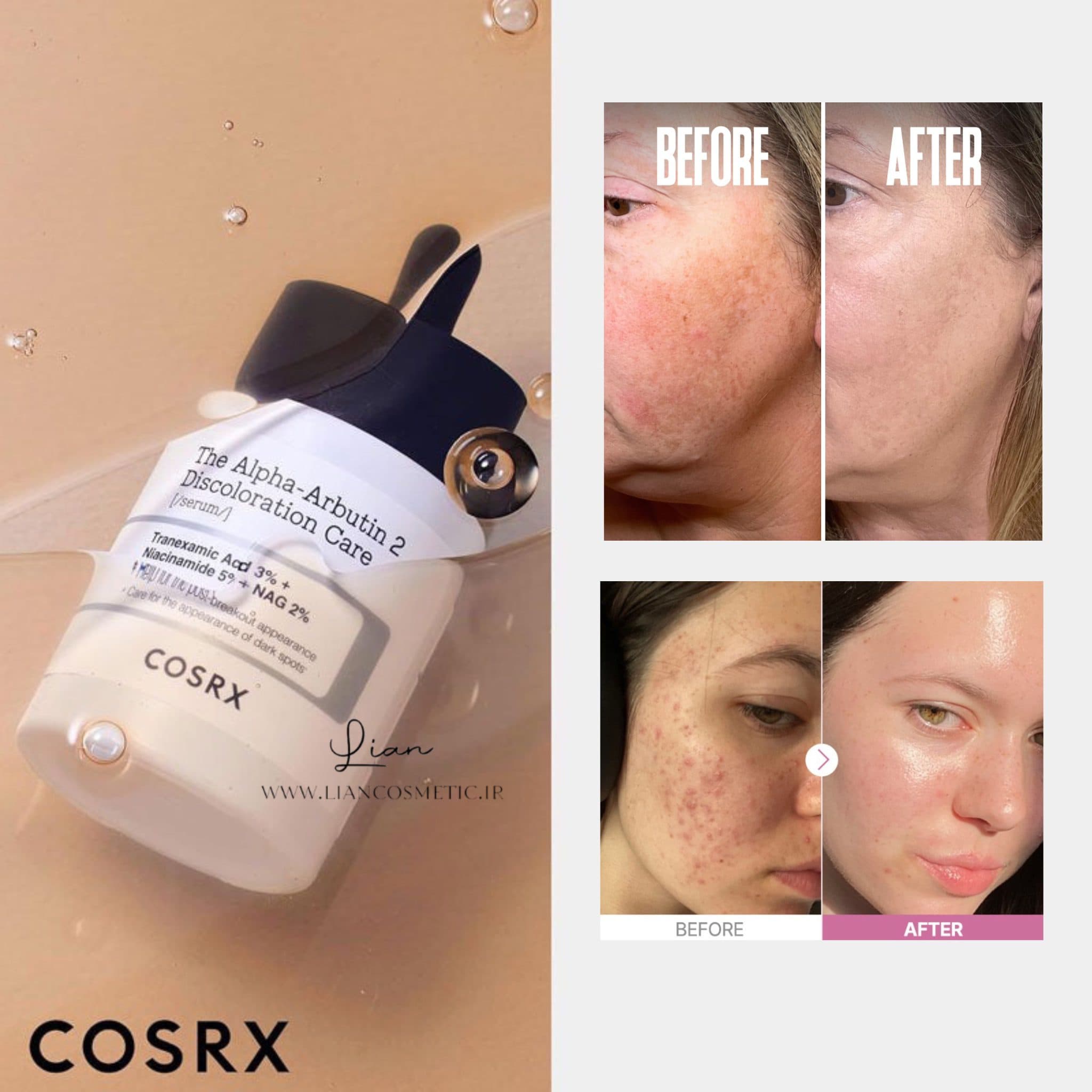 سرم آلفا آربوتین 2 درصد کوزارکس COSRX The Alpha-Arbutin 2 Discoloration Care serum — تصویر ۱۰