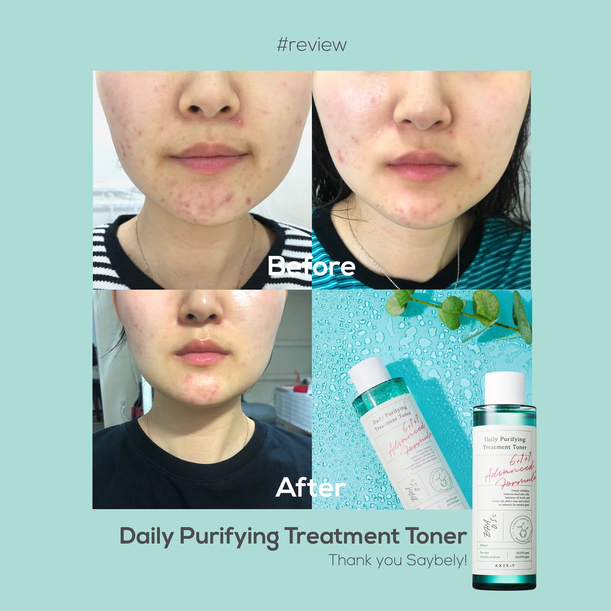 تونر ضدجوش و درمانی اکسیس وای AXIS-Y Daily Purifying Treatment Toner — تصویر ۱۲