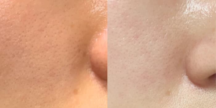 سرم ضد لک روشن کننده ویتامین سی نامبر 5 نامبوزین Numbuzin No.5 Vitamin Concentrated Serum — تصویر ۵