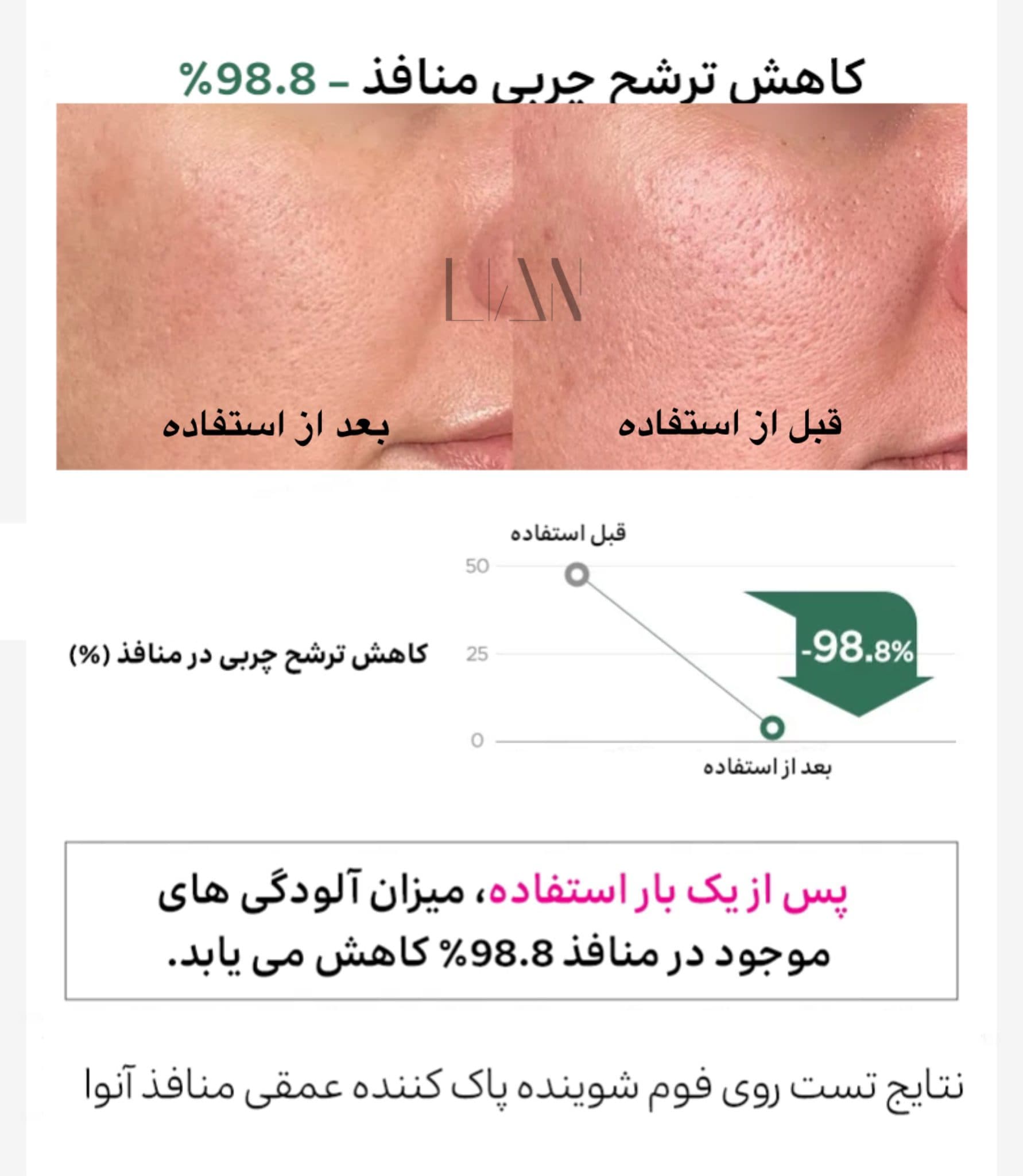 فوم شوینده پاک کننده عمقی منافذ آنوا | Heartleaf Quercetinol-لیان کازمتیک — تصویر ۸