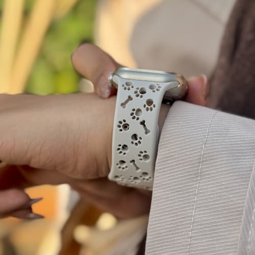 بند سیلیکونی پنجه گربه ای — تصویر ۱۲