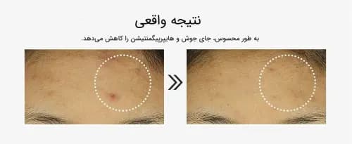 سرم 6 پپتاید کوزارکس COSRX — تصویر ۵