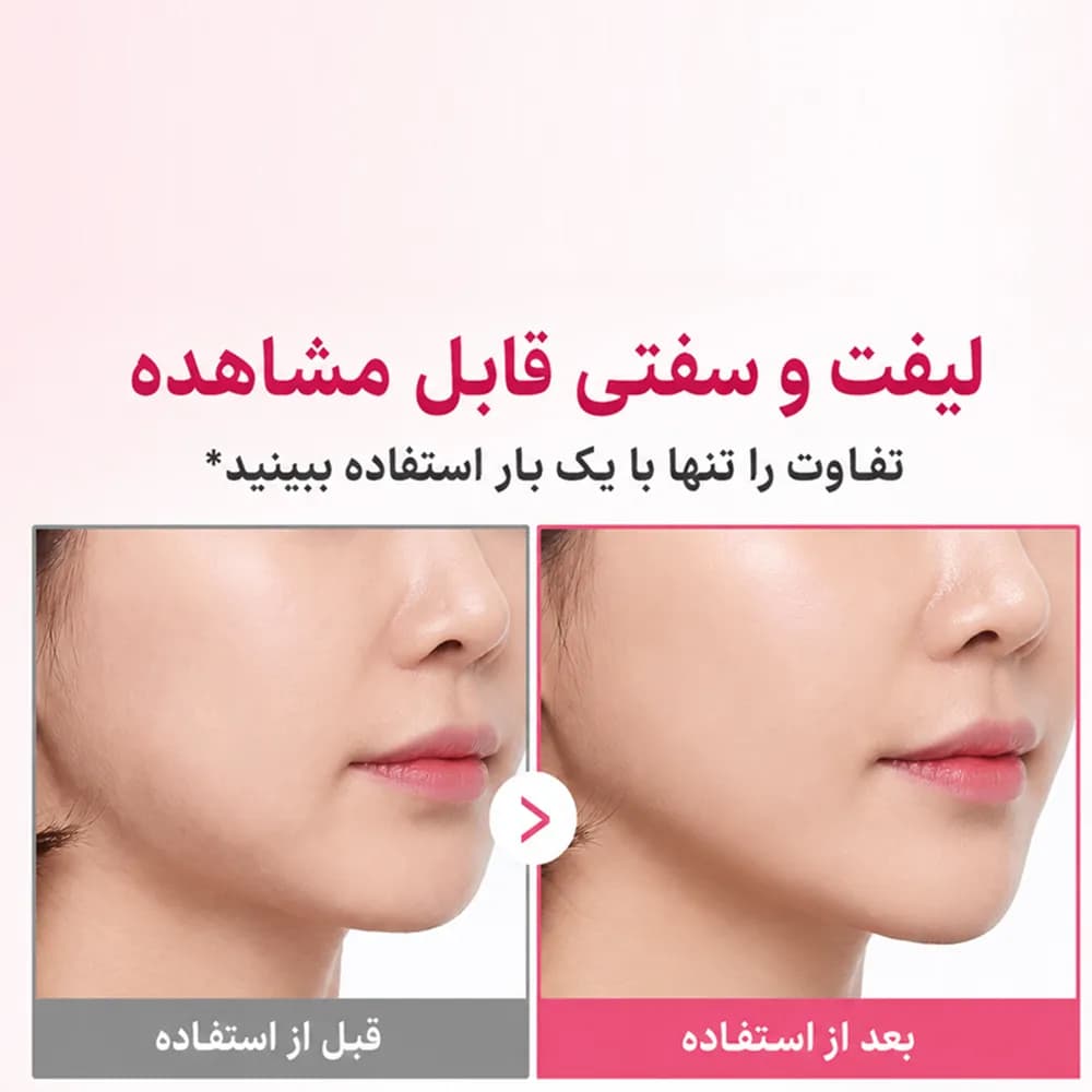 کرم ضد چروک گردن کلاژن PDRN گواشا مدیکیوب — تصویر ۷