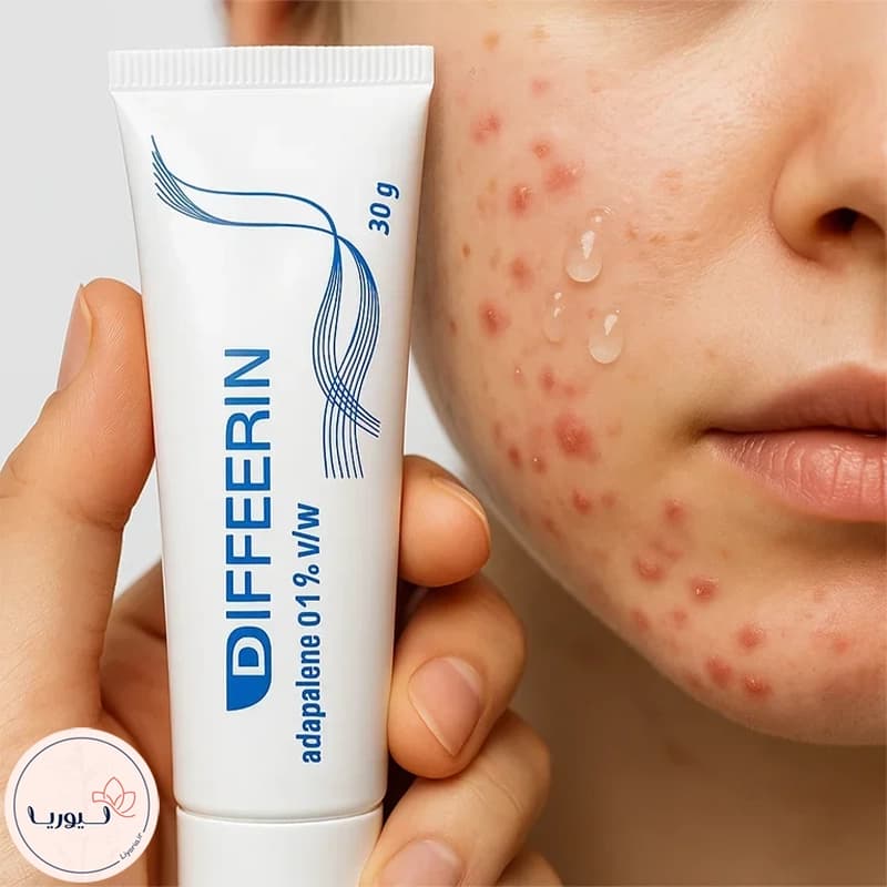 ژل ضد جوش دیفرین مدل Adapalene — تصویر ۴
