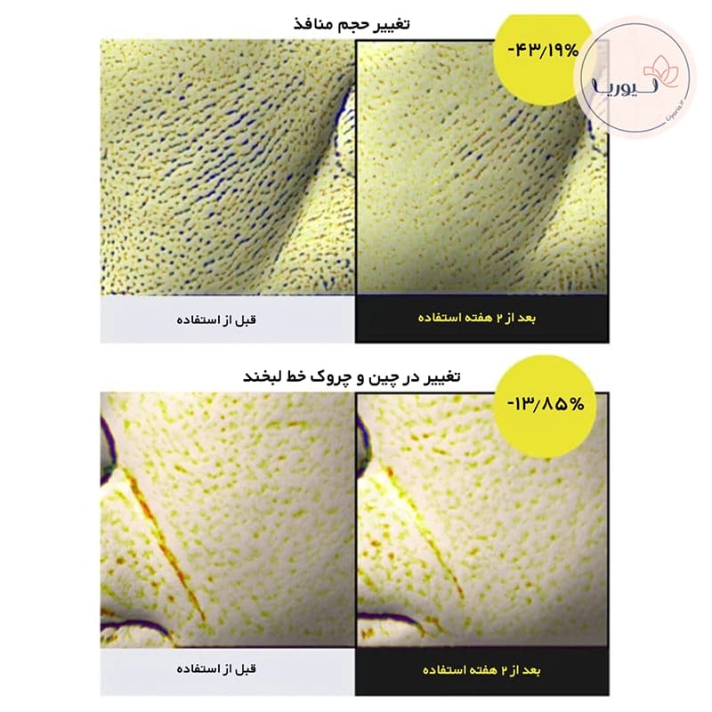 سرم ضدچروک رتینول شات سلیمکس — تصویر ۶