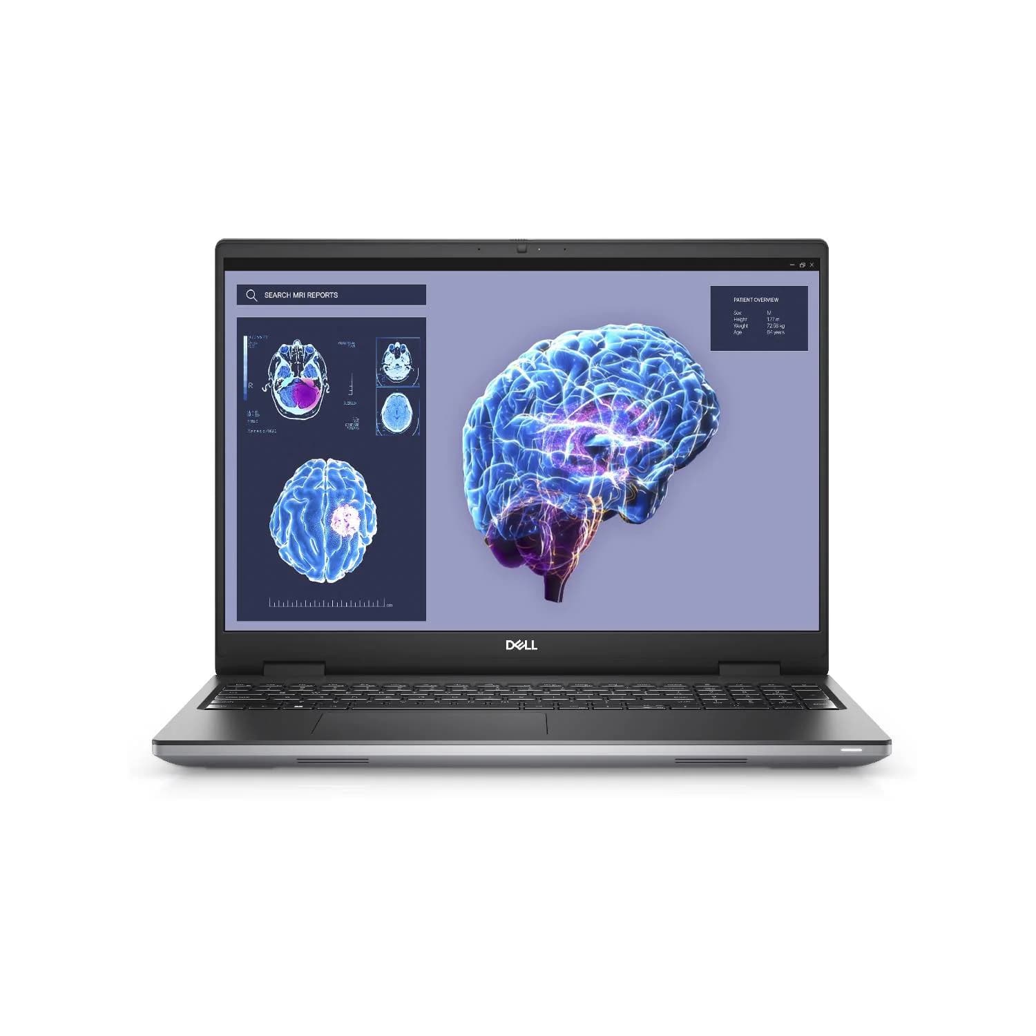 DELL LATITUDE 3551 — تصویر ۲