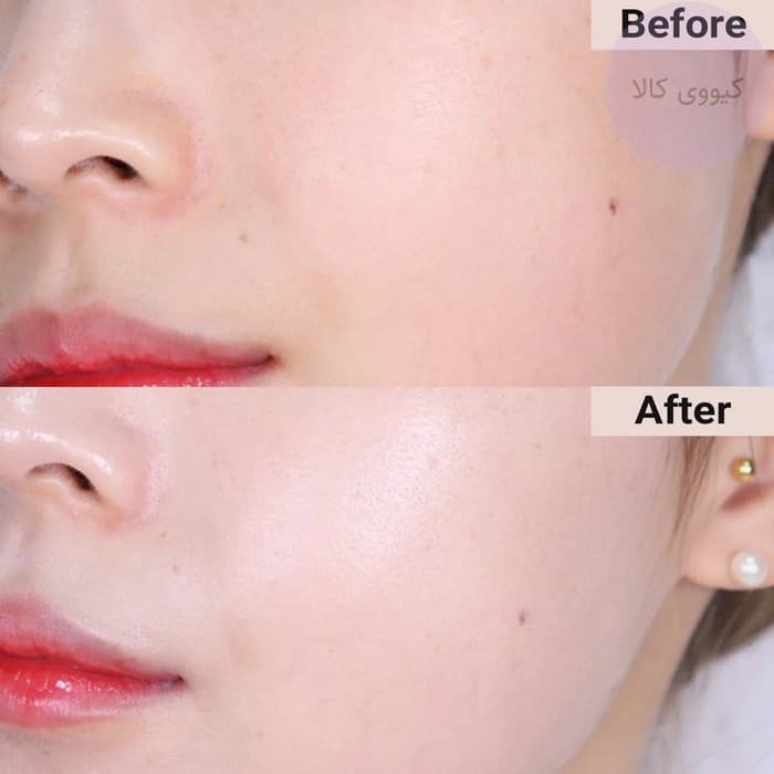 ضد آفتاب روشن کننده تون آپ سنتلا اسکین skin 1004 تون برایتنینگ tone brightening — تصویر ۶