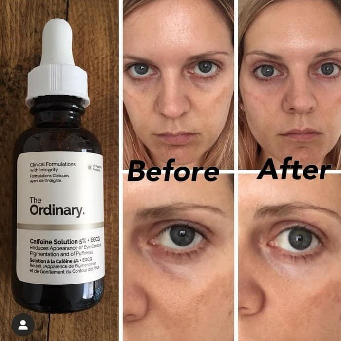 سرم کافئین اوردینری The Ordinary ضد تیرگی و پف دور چشم اصل — تصویر ۵