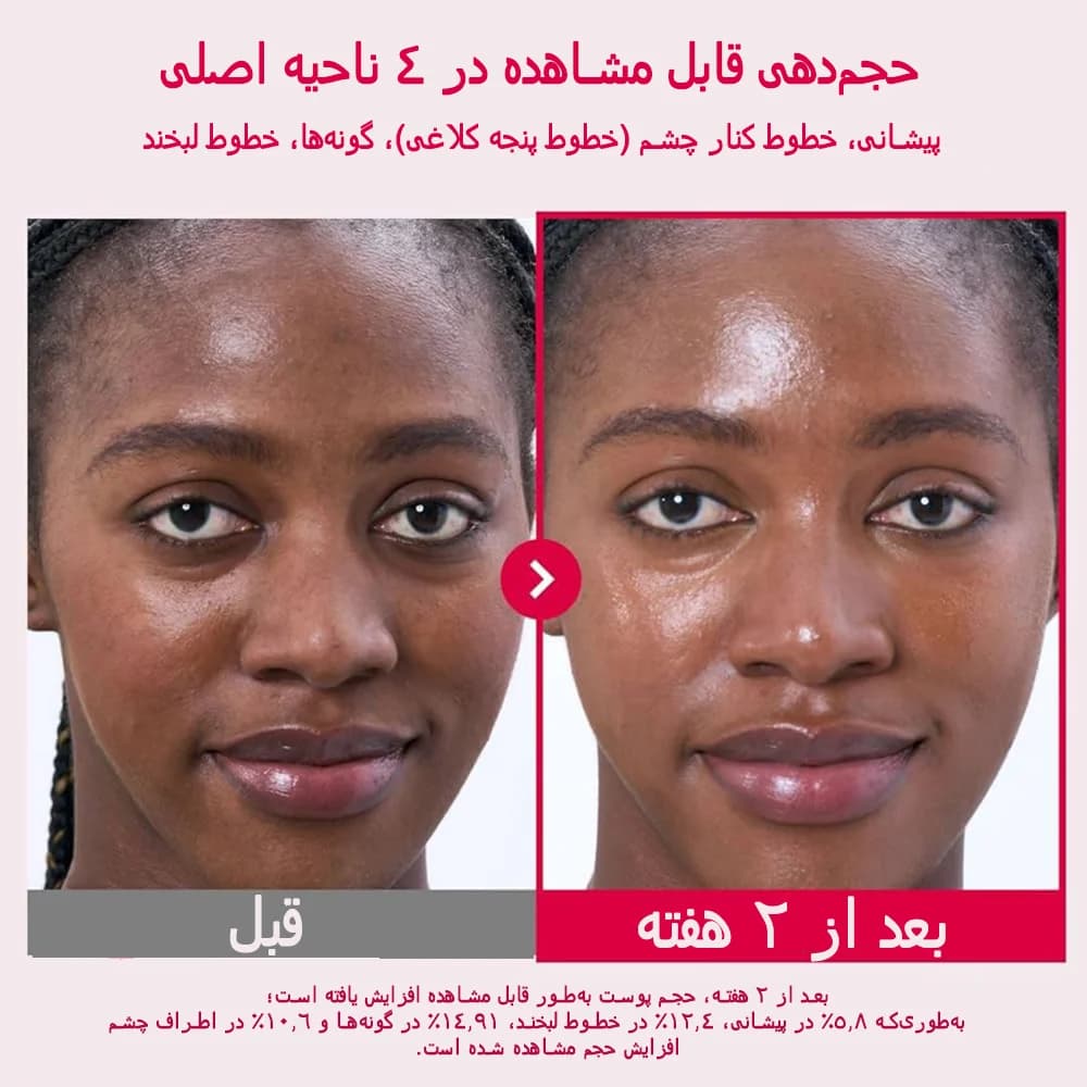 سرم PDRN کلاژن حجم دهنده و جوانساز نامبوزین شماره ۲ با رایحه گل رز — تصویر ۴