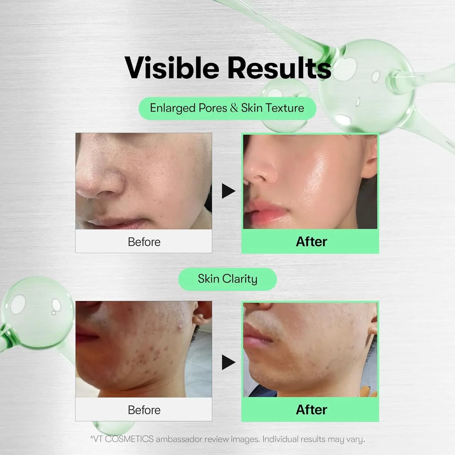 سرم میکرونیدلینگ ریدل شات سیکا هیالون 100 برند وی تی اصل — تصویر ۴