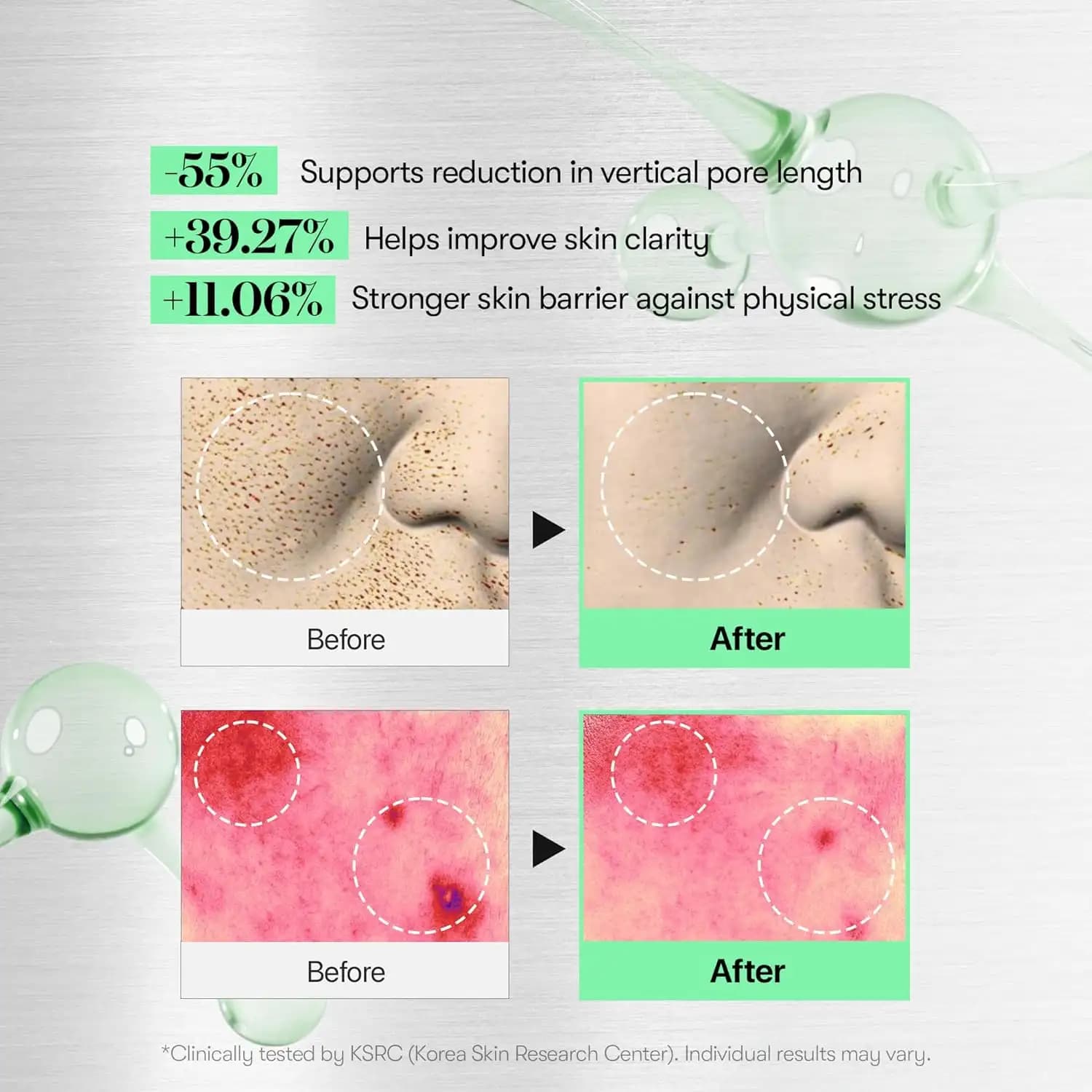 سرم میکرونیدلینگ ریدل شات سیکا هیالون 100 برند وی تی اصل — تصویر ۵