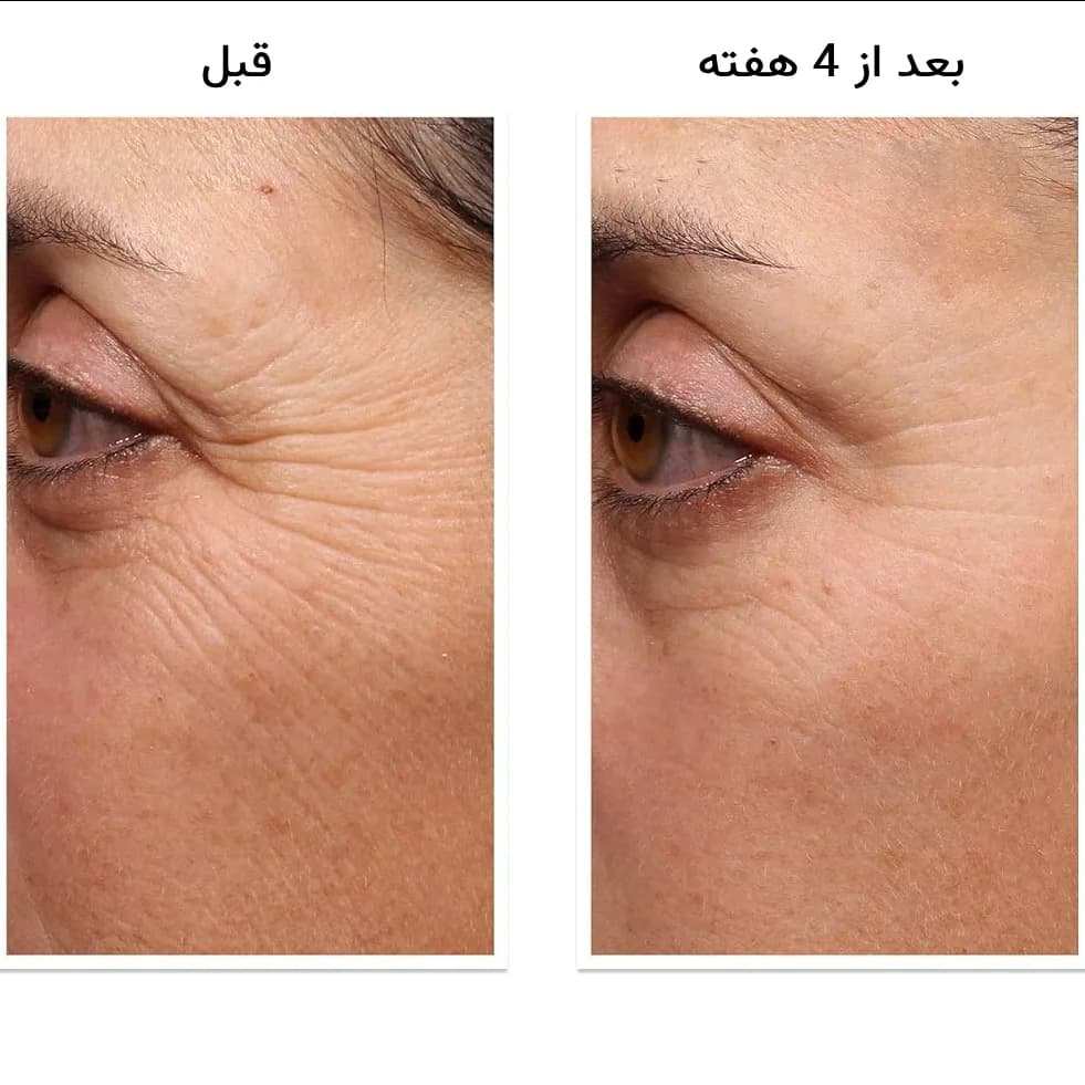 کرم دور چشم رتینول دکتر مورد جوانساز قوی و ضدچروک Dr Murad — تصویر ۵