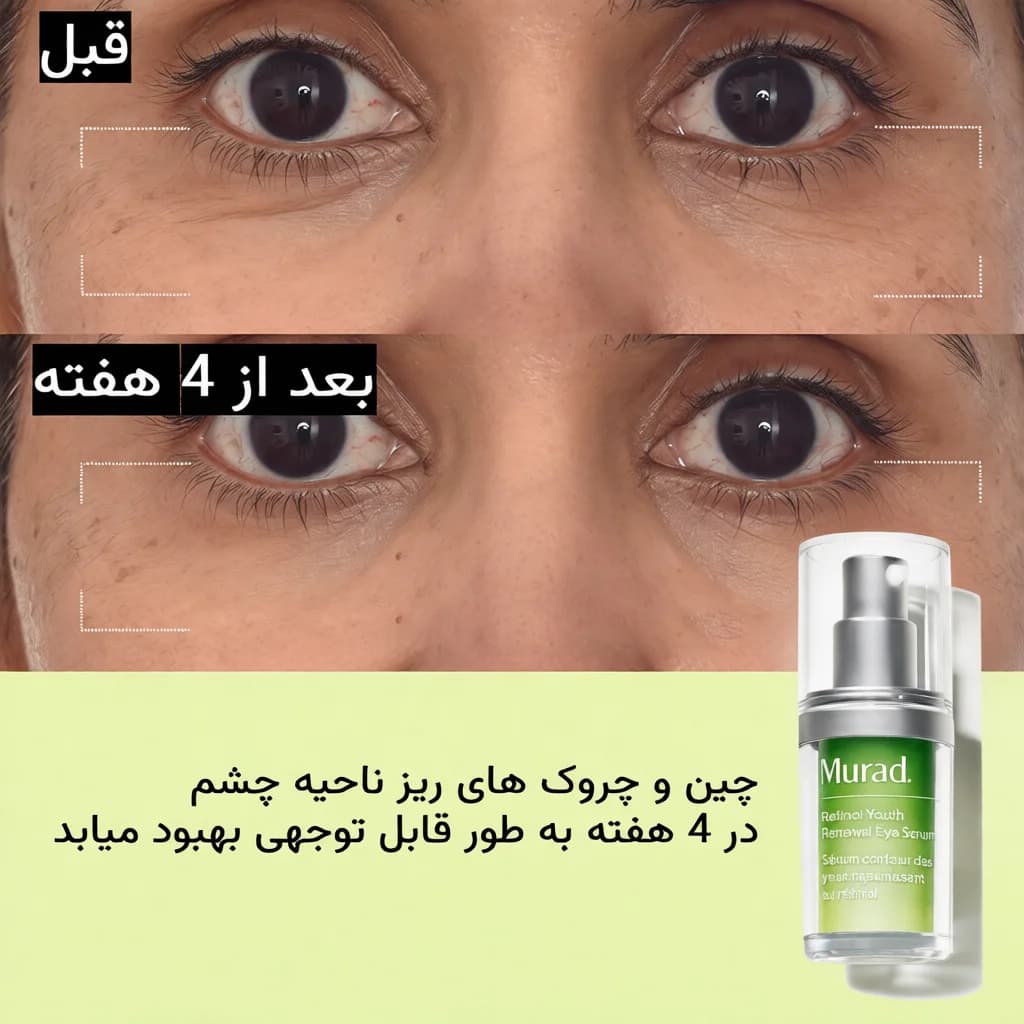 کرم دور چشم رتینول دکتر مورد جوانساز قوی و ضدچروک Dr Murad — تصویر ۳