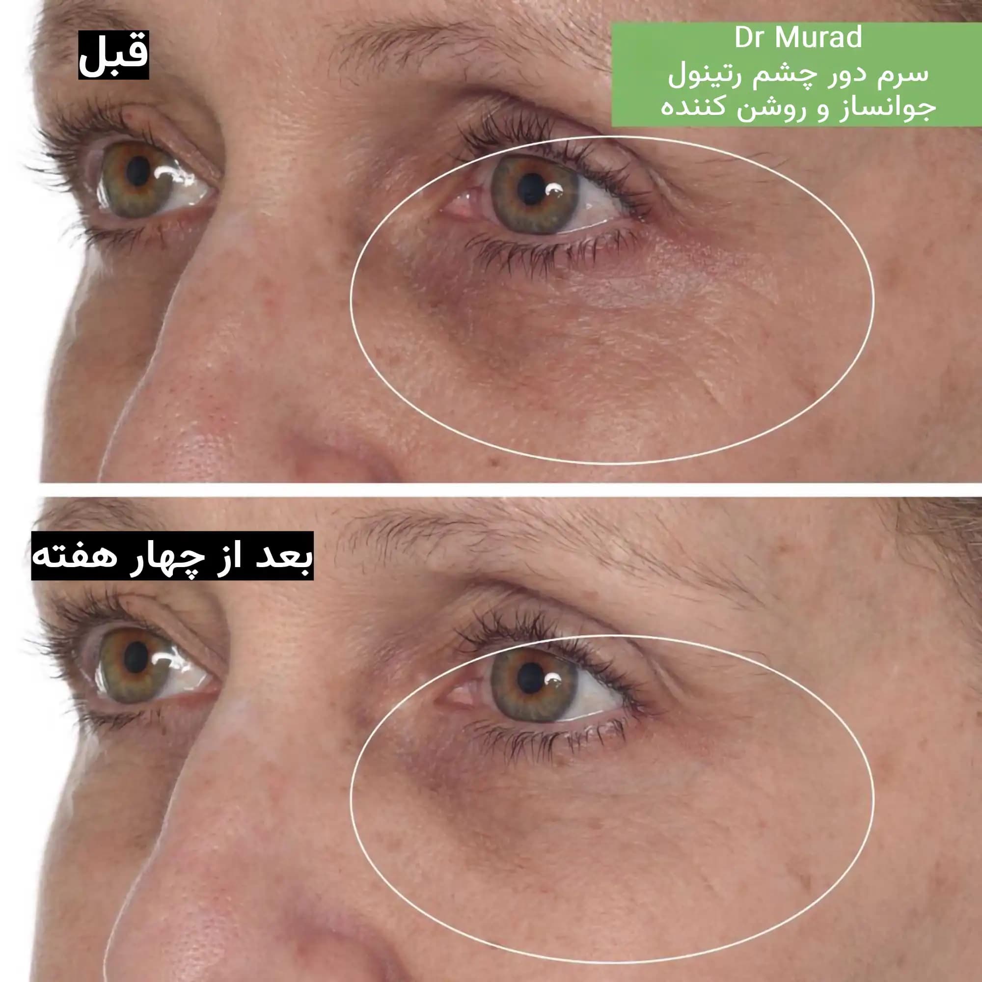 کرم دور چشم رتینول دکتر مورد جوانساز قوی و ضدچروک Dr Murad — تصویر ۴