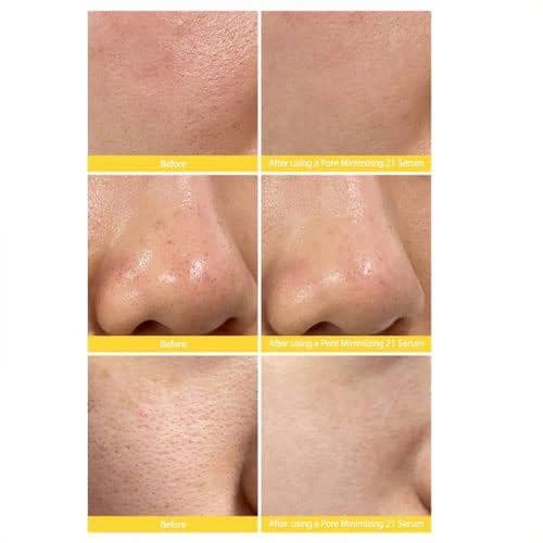 سرم روشن کننده و کنترل کننده منافذ تیام — تصویر ۳