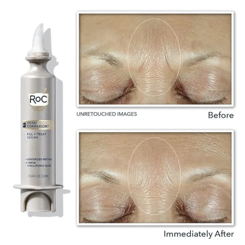 سرم فیلر پر کننده چین و چروک راک Roc حاوی رتینول و سرم اسید هیالورونیک Roc derm correxion fill treat serum refill — تصویر ۴
