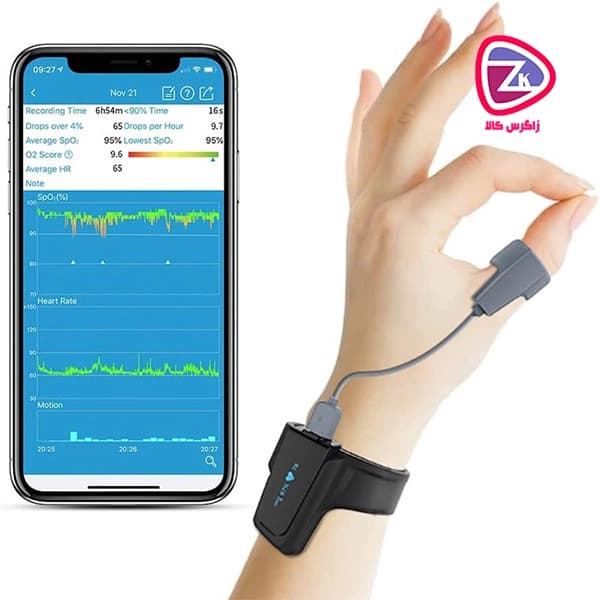 دستگاه پالس اکسیمتر مچی Checkme O2 MAX + مچ بند آنالیز خواب — تصویر ۴