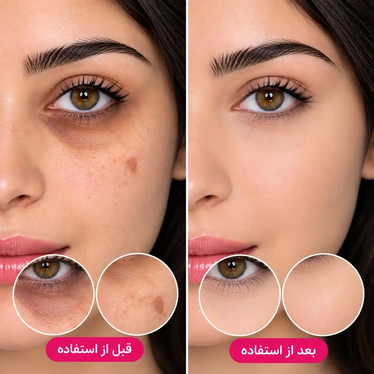 کانسیلر ایزادورا Isadora | پوشاننده قوی لک و تیرگی صورت — تصویر ۳