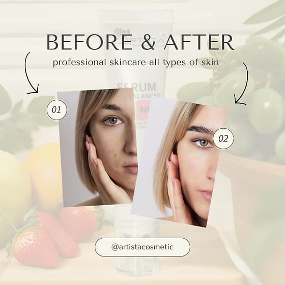 سرم ترمیم کننده پوست آرتیستا | Artista Skin balanced — تصویر ۵