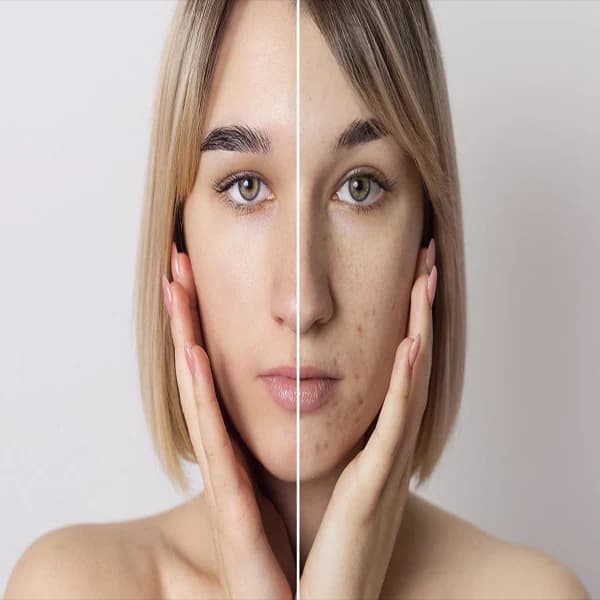 سرم ترمیم کننده پوست آرتیستا | Artista Skin balanced — تصویر ۶