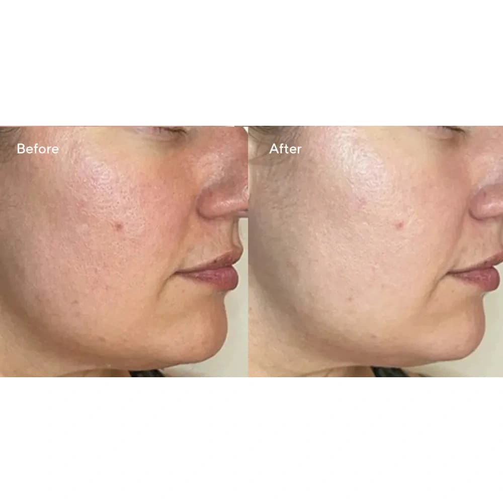 سرم ضد آفتاب ضد لک SPF45 دکتر مورد — تصویر ۶