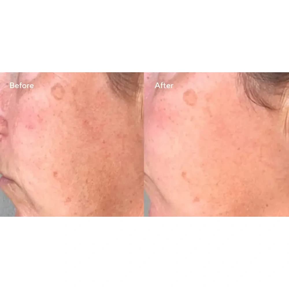 سرم ضد آفتاب ضد لک SPF45 دکتر مورد — تصویر ۷