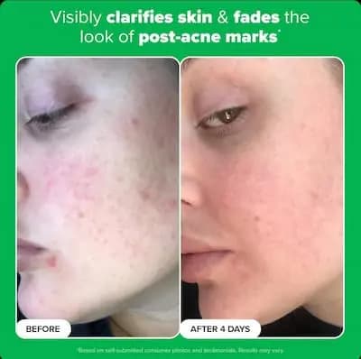 بوستر ضدلک آزلائیک اسید ۱۰٪ پائولاز چویس فول سایز 30ml — تصویر ۵