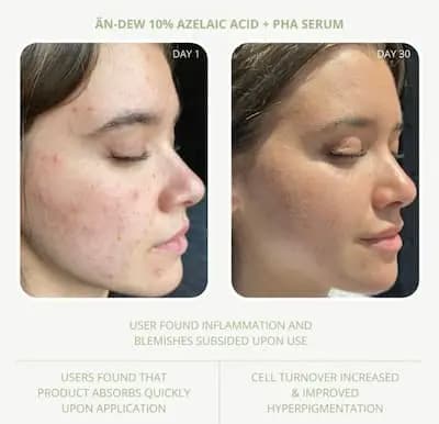 بوستر ضدلک آزلائیک اسید ۱۰٪ پائولاز چویس فول سایز 30ml — تصویر ۶
