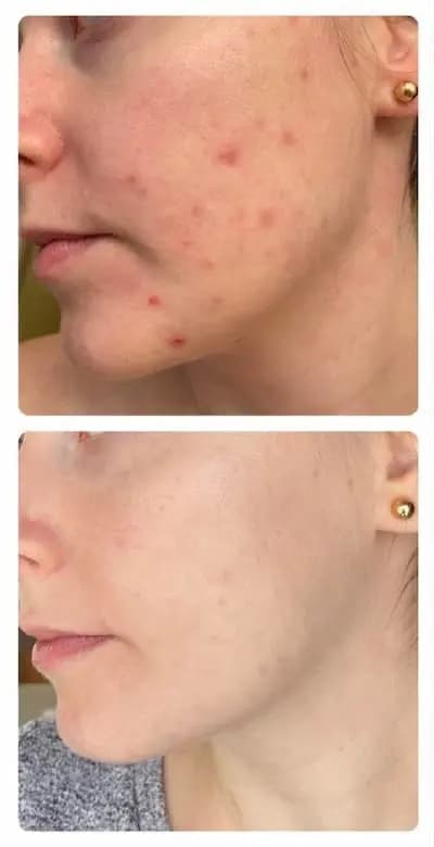 بوستر ضدلک آزلائیک اسید ۱۰٪ پائولاز چویس فول سایز 30ml — تصویر ۲