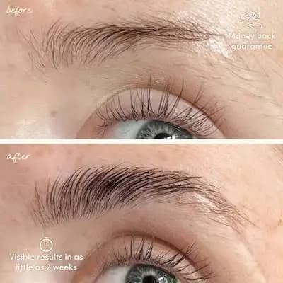 سرم‌تقویت‌کننده ابرو و مژه آگوستینوس بادر فول سایز 8ml — تصویر ۸