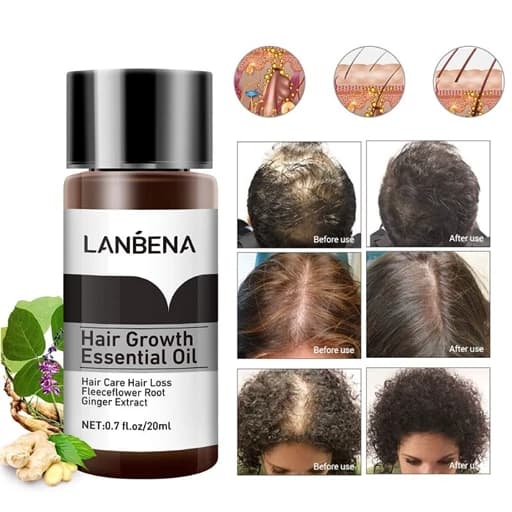 سرم(قطره)تقویت و ضدریزش مو لانبنا LANBENA — تصویر ۲
